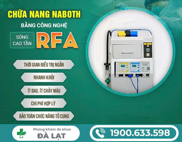 Hình ảnh minh họa